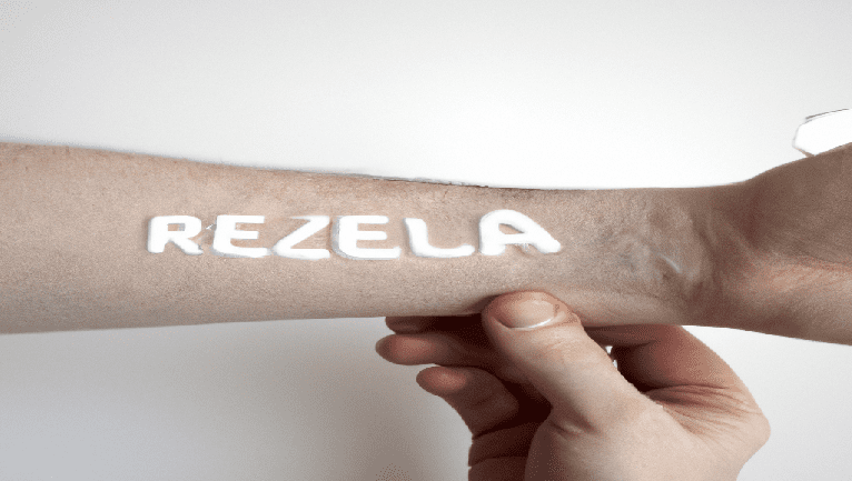 Understanding Eczema: What You Need To Know